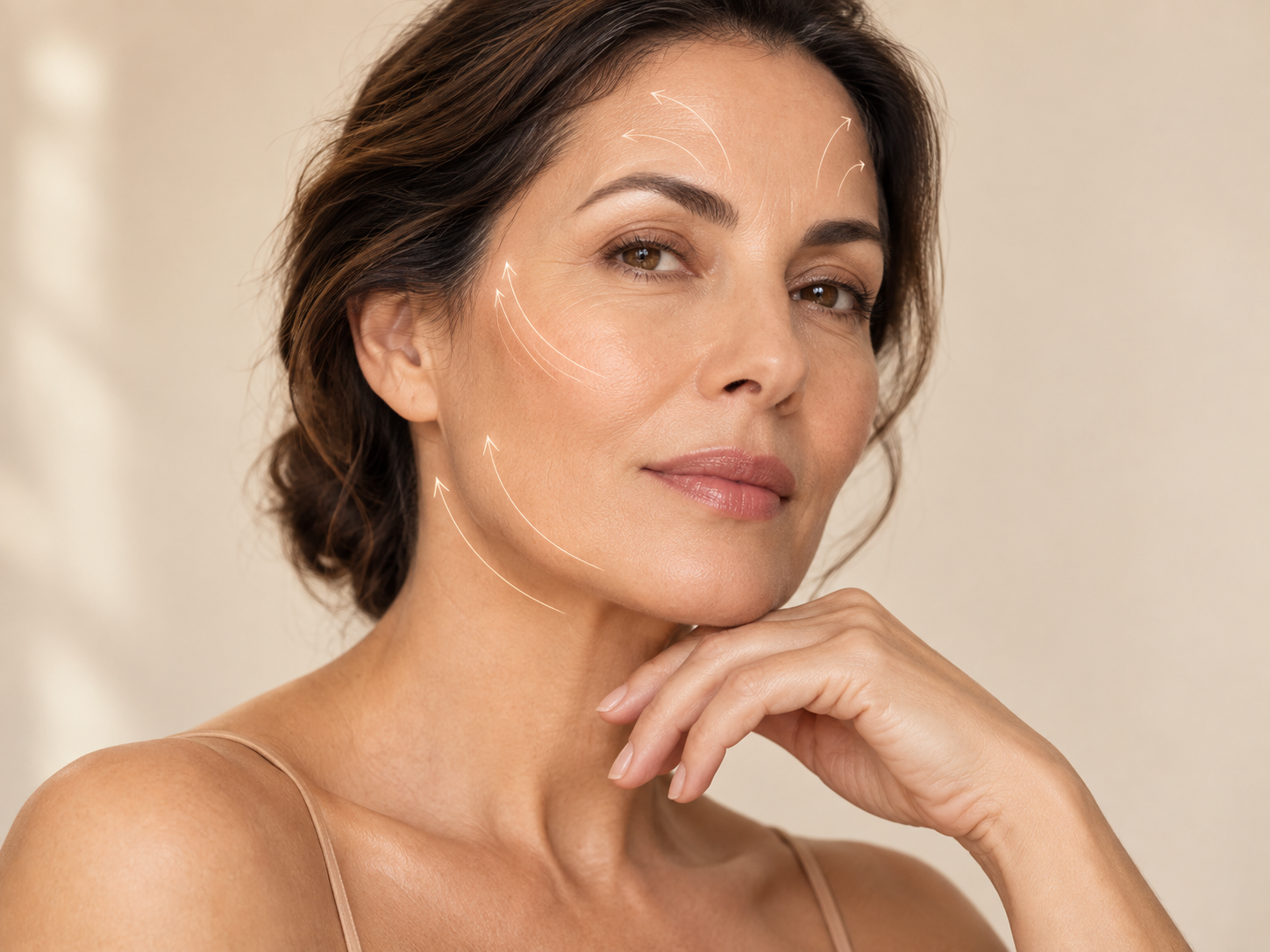Exemplo de flacidez facial